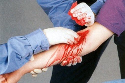 Un herido tiene hemorragia en el brazo qué debe hacer